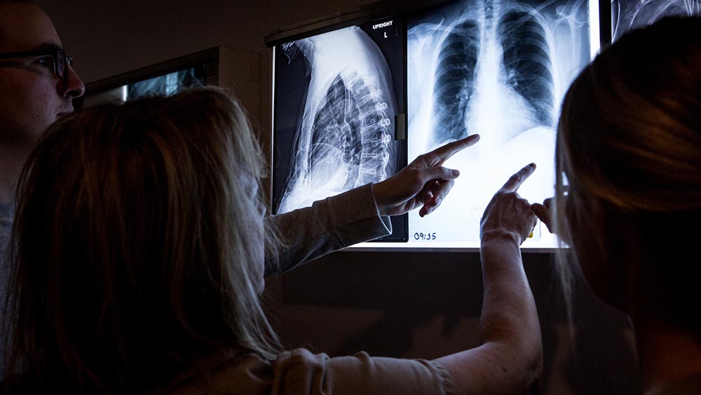 Nurses look at an x-ray.